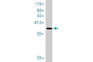 Western Blot detection against Immunogen (41. (TXNL4A antibody  (AA 1-142))