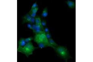 Image no. 2 for anti-Melan A (MLANA) antibody (ABIN1499425) (MLANA antibody)