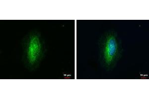 ICC/IF Image ARHGAP1 antibody [N1N3] detects ARHGAP1 protein at cytoplasm by immunofluorescent analysis. (ARHGAP1 antibody  (N-Term))