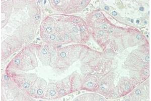 Human Kidney: Formalin-Fixed, Paraffin-Embedded (FFPE) (SLC3A2 antibody  (AA 89-433))