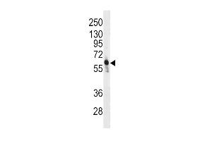 Western blot analysis of anti-PFKFB3 Antibody (C-term) (ABIN392768 and ABIN2842213) in CEM cell line lysates (35 μg/lane). (PFKFB3 antibody  (C-Term))