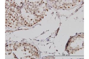 Immunoperoxidase of monoclonal antibody to MLH1 on formalin-fixed paraffin-embedded human testis. (MLH1 antibody  (AA 1-756))