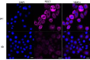 anti-rho-Associated, Coiled-Coil Containing Protein Kinase 2 (ROCK2) antibody