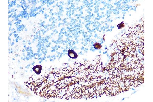 ITPR1 antibody