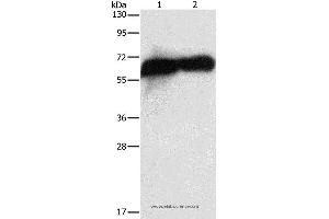 Western blot analysis of HepG2 cell and human placenta tissue, using ALPP Polyclonal Antibody at dilution of 1:1450 (PLAP antibody)