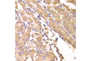Immunohistochemistry of paraffin-embedded human stomach using SUFU antibody (ABIN5974087) at dilution of 1/100 (40x lens). (SUFUH antibody)