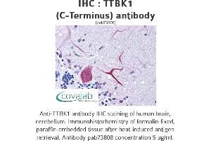 Image no. 1 for anti-tau Tubulin Kinase 1 (Ttbk1) (C-Term) antibody (ABIN1740433)