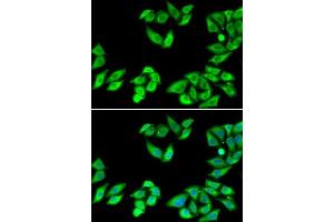 Immunofluorescence analysis of MCF7 cells using RPS14 antibody. (RPS14 antibody  (AA 1-151))
