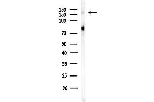 anti-Wolf-Hirschhorn Syndrome Candidate 1-Like 1 (WHSC1L1) (N-Term) antibody