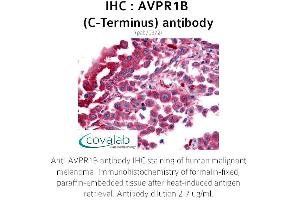 Image no. 1 for anti-Arginine Vasopressin Receptor 1B (AVPR1B) (C-Term) antibody (ABIN1732149)