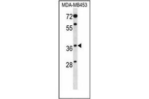 Western blot analysis of PAQR8 Antibody (C-term) in MDA-MB453 cell line lysates (35ug/lane).