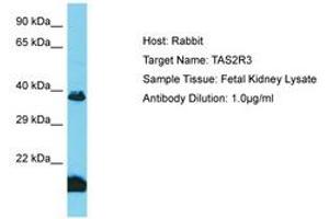 Image no. 1 for anti-Taste Receptor, Type 2, Member 3 (TAS2R3) (AA 129-178) antibody (ABIN6750602)