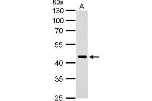 ERCC8 antibody  (Center)