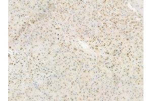 ABIN6254903 and ABIN6267564 at 1/100 staining human normal liver tissue by IHC-P.