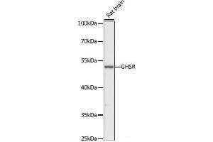 Western blot analysis of extracts of Rat brain using GHSR Polyclonal Antibody at dilution of 1:1000. (GHSR antibody)