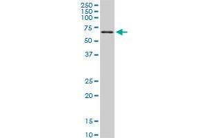 TBX18 monoclonal antibody (M06), clone 4D3. (T-Box 18 antibody  (AA 454-560))