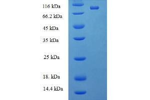 SDS-PAGE (SDS) image for DEAD (Asp-Glu-Ala-As) Box Polypeptide 19A (DDX19A) (AA 1-478), (full length) protein (His-SUMO Tag) (ABIN5711934)
