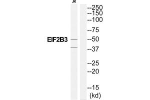 Western Blotting (WB) image for anti-Eukaryotic Translation Initiation Factor 2B, Subunit 3 Gamma, 58kDa (EIF2B3) (Internal Region) antibody (ABIN1852310) (EIF2B3 antibody  (Internal Region))