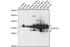 Western blot analysis of extracts of various cell lines, using SUCLG1 antibody.
