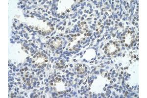 Immunohistochemistry (IHC) image for anti-SWI/SNF Related, Matrix Associated, Actin Dependent Regulator of Chromatin, Subfamily E, Member 1 (SMARCE1) (N-Term) antibody (ABIN2780465)