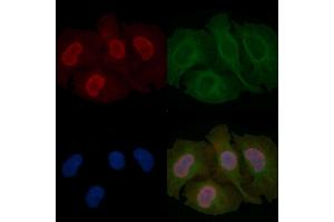 FOXD2 Mouse Monoclonal Antibody staining Hela cells by IF/ICC.