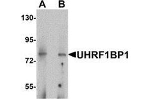 Western blot analysis of UHRF1BP1 in mouse kidney tissue lysate with UHRF1BP1 antibody at (A) 1 and (B) 2 μg/mL (UHRF1BP1 antibody  (Middle Region))