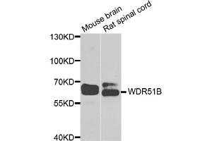 Western blot analysis of extracts of various cell lines, using POC1B antibody (ABIN5974757) at 1/1000 dilution. (POC1B antibody)