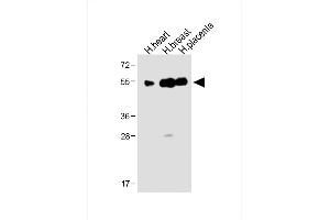 All lanes : Anti-ENT1 Antibody (C-term) at 1:1000 dilution Lane 1: Human heart lysate Lane 2: Human breast lysate Lane 3: Human placenta lysate Lysates/proteins at 20 μg per lane. (SLC29A1 antibody  (C-Term))