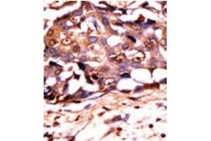 Image no. 1 for anti-Signal Transducer and Activator of Transcription 3 (Acute-Phase Response Factor) (STAT3) (pTyr705) antibody (ABIN358234) (STAT3 antibody  (pTyr705))