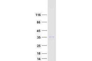 Validation with Western Blot (TSNAX Protein (Myc-DYKDDDDK Tag))