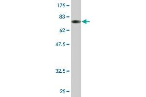 Western Blot detection against Immunogen (80. (ALDH1A1 antibody  (AA 1-501))