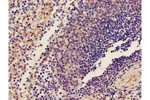 Immunohistochemistry of paraffin-embedded human spleen tissue using ABIN7163589 at dilution of 1:100 (CD42a antibody  (AA 17-88))