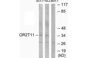 Western Blotting (WB) image for anti-Olfactory Receptor, Family 2, Subfamily T, Member 11 (OR2T11) (Internal Region) antibody (ABIN1853118) (OR2T11 antibody  (Internal Region))