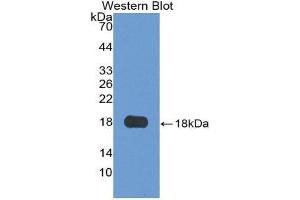 Western Blotting (WB) image for anti-Granulin (GRN) (AA 21-120) antibody (ABIN1175737) (Granulin antibody  (AA 21-120))