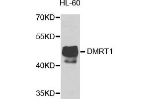 Western blot analysis of extracts of HL-60 cells, using DMRT1 antibody. (DMRT1 antibody)