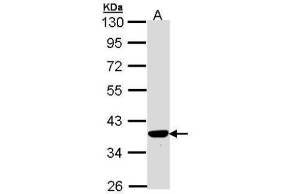 TP53I3 Antikörper