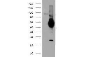 Western Blotting (WB) image for anti-CD5 (CD5) antibody (ABIN1497337) (CD5 antibody)