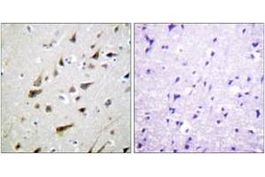 Immunohistochemistry analysis of paraffin-embedded human brain tissue, using Calsenilin/KCNIP3 (Ab-63) Antibody. (DREAM antibody  (AA 29-78))
