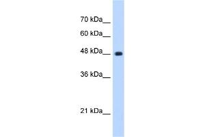 WB Suggested Anti-UNC84B Antibody Titration:  0. (SUN2 antibody  (C-Term))