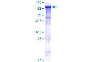 Image no. 1 for Kelch-Like 22 (KLHL22) (AA 1-634) protein (GST tag) (ABIN1308809) (KLHL22 Protein (AA 1-634) (GST tag))
