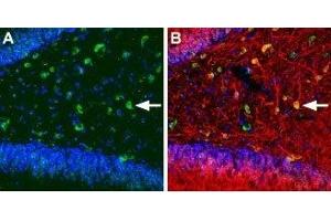 Expression of KCNQ5 in rat hippocampus - Immunohistochemical staining of immersion-fixed, free floating rat brain frozen sections using Anti-KCNQ5 Antibody (ABIN7043507, ABIN7045050 and ABIN7045051), (1:100). (KCNQ5 antibody  (Intracellular))