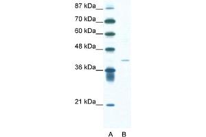 Western Blotting (WB) image for anti-Hypoxia Inducible Factor 1, alpha Subunit Inhibitor (HIF1AN) (N-Term) antibody (ABIN2777654)