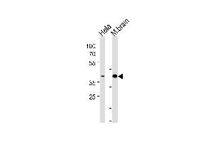 ATF2 Antibody (p) (ABIN1538301 and ABIN2848542) western blot analysis in Hela cell line and mouse brain tissue lysates (35 μg/lane). (ATF2 antibody  (AA 318-347))