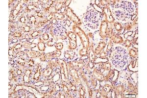 Paraformaldehyde-fixed, paraffin embedded rat kidney tissue, Antigen retrieval by boiling in sodium citrate buffer(pH6) for 15min, Block endogenous peroxidase by 3% hydrogen peroxide for 30 minutes, Blocking buffer (normal goat serum) at 37°C for 20min, Antibody incubation with Rabbit Anti-SIRT4 Polyclonal Antibody, Unconjugated  at 1:400 overnight at 4°C, followed by a conjugated secondary and DAB staining (SIRT4 antibody  (AA 51-150))