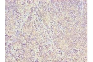 Immunohistochemistry of paraffin-embedded human tonsil tissue using ABIN7157054 at dilution of 1:100 (ISCA2 antibody  (AA 9-154))