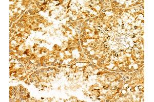 anti-Forkhead Box R2 (FOXR2) (Internal Region) antibody