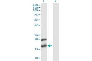 Western Blot analysis of PTN expression in transfected 293T cell line by PTN monoclonal antibody (M02), clone 2E3. (Pleiotrophin antibody  (AA 45-154))