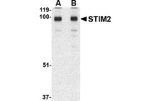 Western Blotting (WB) image for anti-Stromal Interaction Molecule 2 (Stim2) (C-Term) antibody (ABIN1030707) (Stim2 antibody  (C-Term))