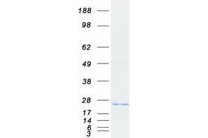 Validation with Western Blot (ARL8B Protein (Myc-DYKDDDDK Tag))