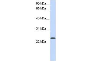Western Blotting (WB) image for anti-ADP-Ribosylation Factor 1 (ARF1) (Middle Region) antibody (ABIN2783267)
